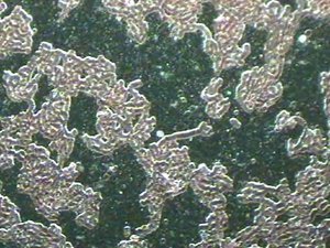 Blood electrification under microscope after using Bob Beck blood electrification device